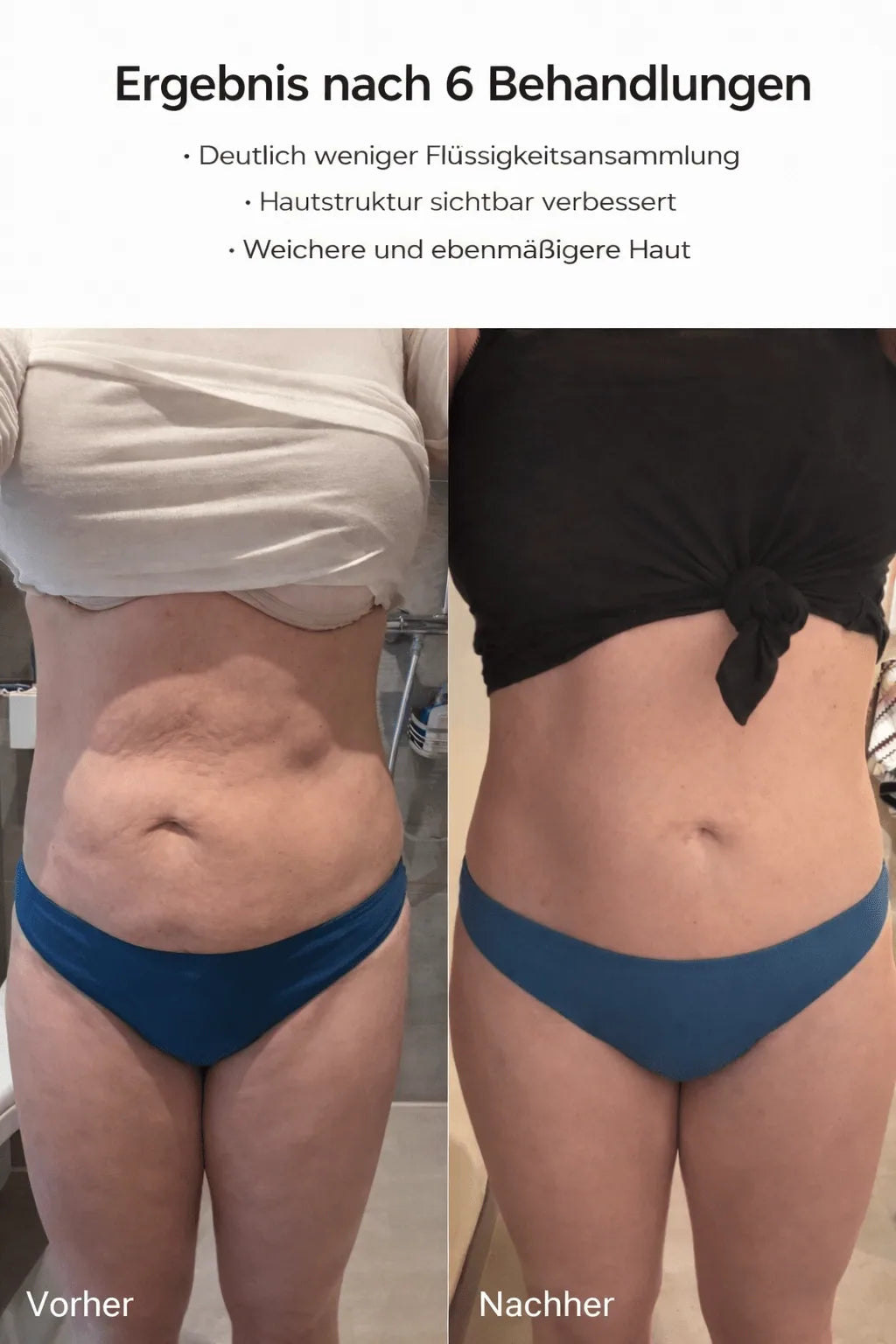 Appareil Lissant Visage Chaleur et Pression